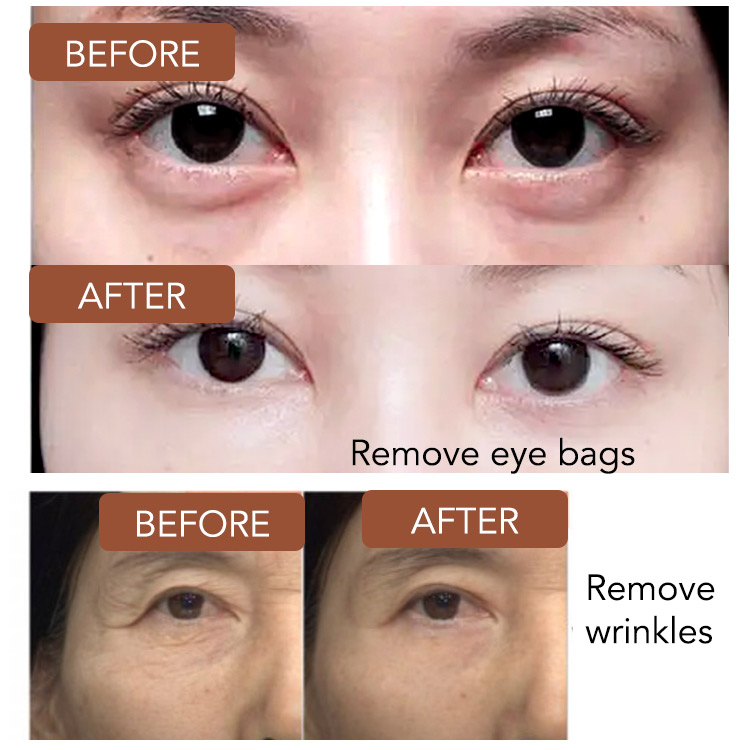 Astaxanthin Caviar Eye Cream-Fades Eye Wrikles/Dark Circles/Eye Bags-Buy 1 Take 1